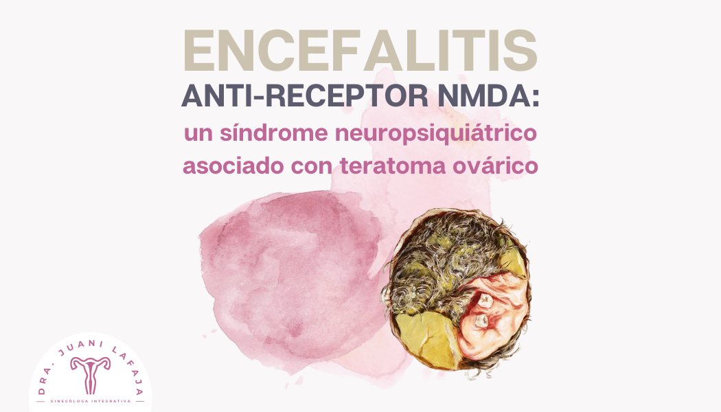 Encefalitis anti-receptor NMDA: un síndrome neuropsiquiátrico asociado con teratoma ovárico
